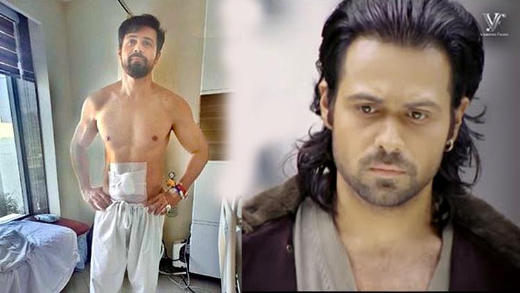 घायल हुए इमरान हाशमी